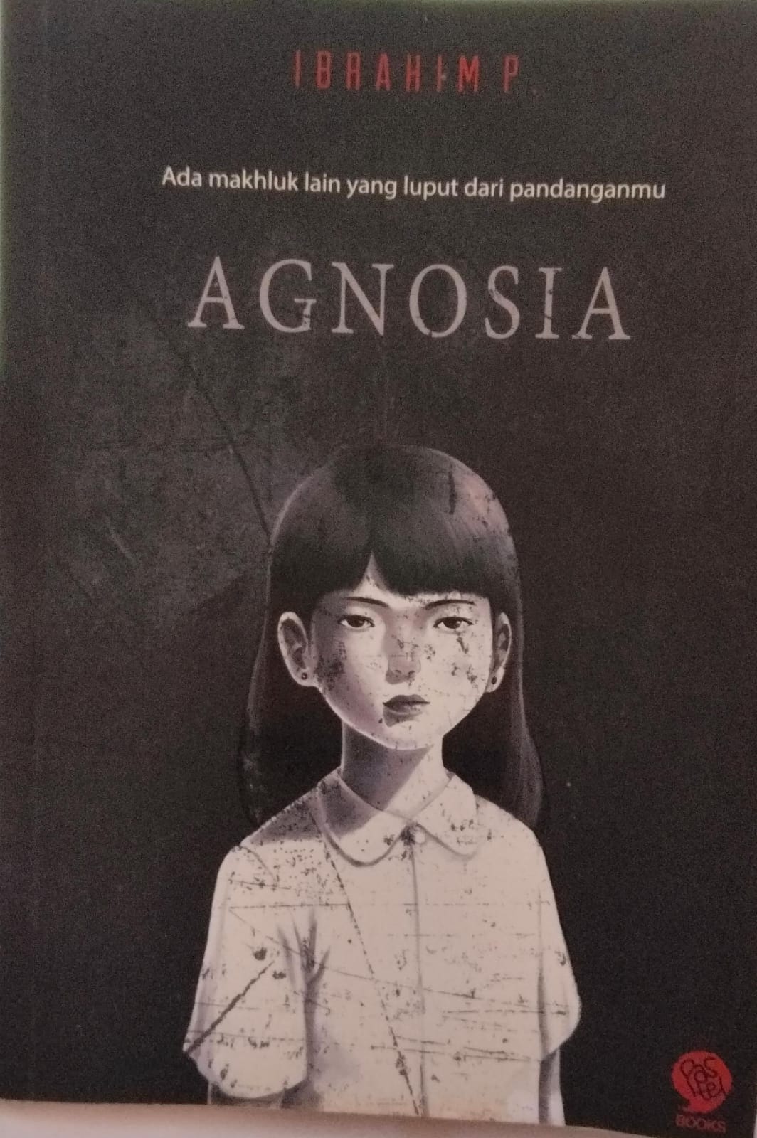 Agnosia